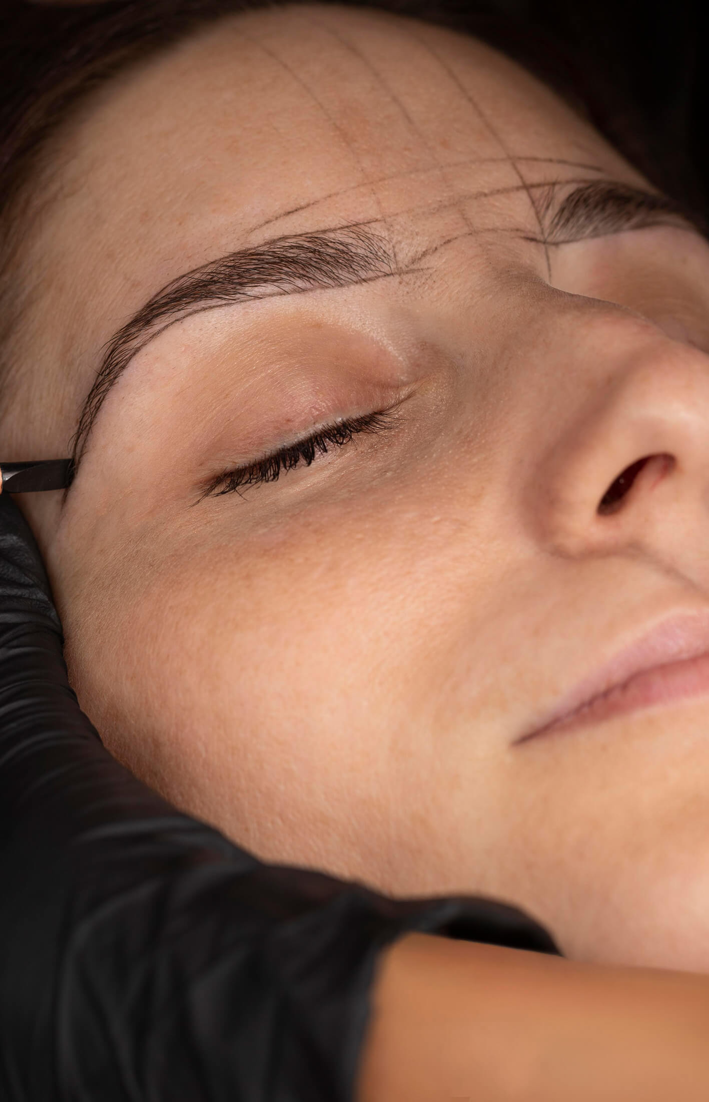 Eyebrow transplant before after